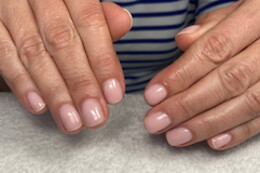 NH Ongles